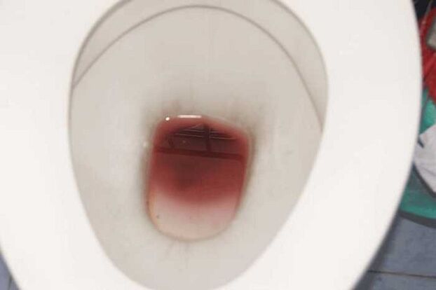 sighting in men when they are excited